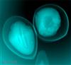 種子胚芽發育狀況檢測內部結構檢測,珍珠層厚度檢測